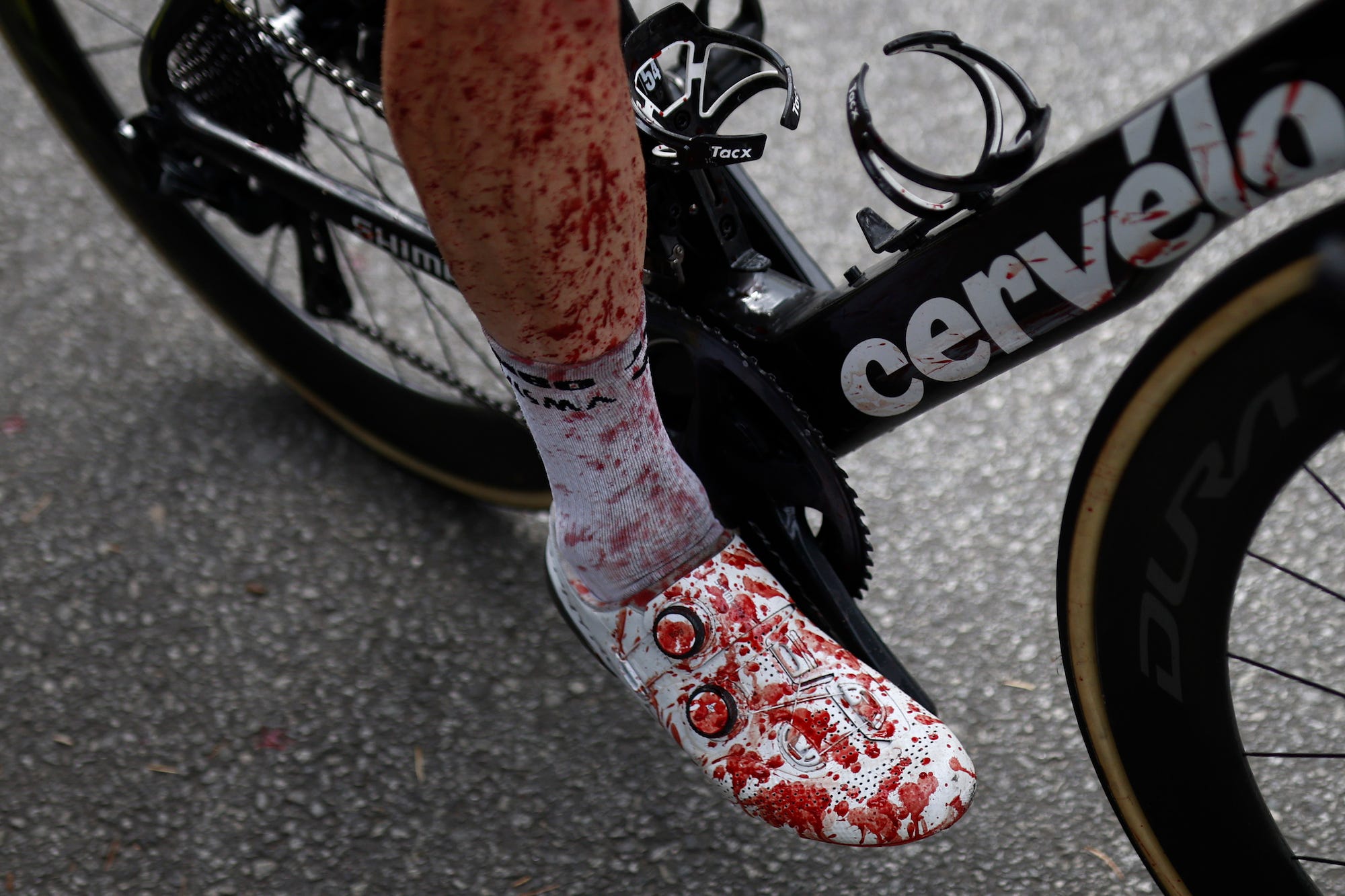 Blood on the leg and shoe of Netherland's Steven Kruijswijk who crashed in the third stage of the Tour de France.